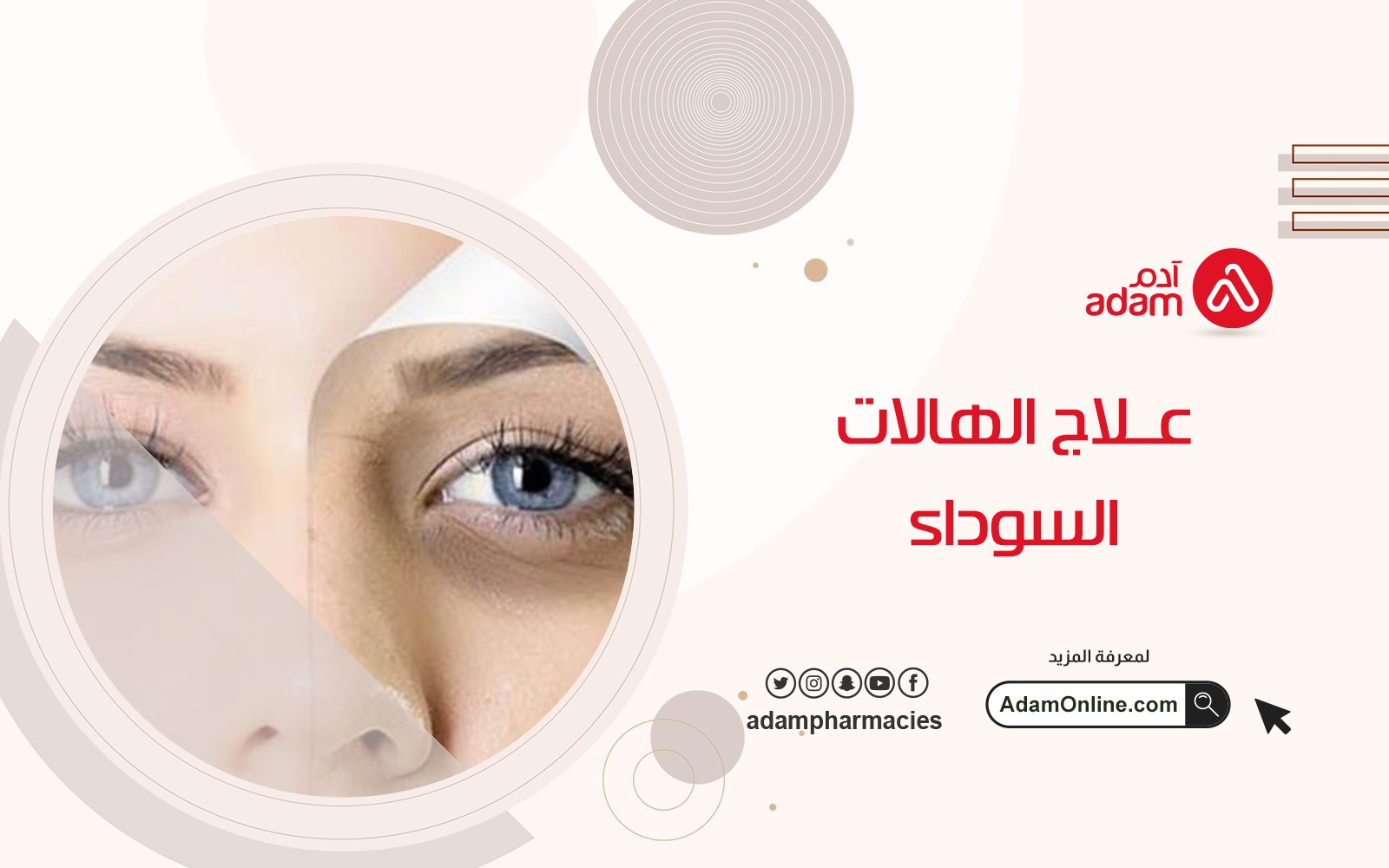 Treatment of dark circles